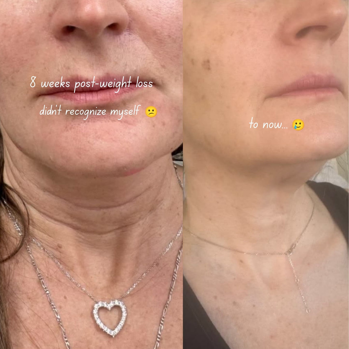 Face & Neck Firming Retinal Stick