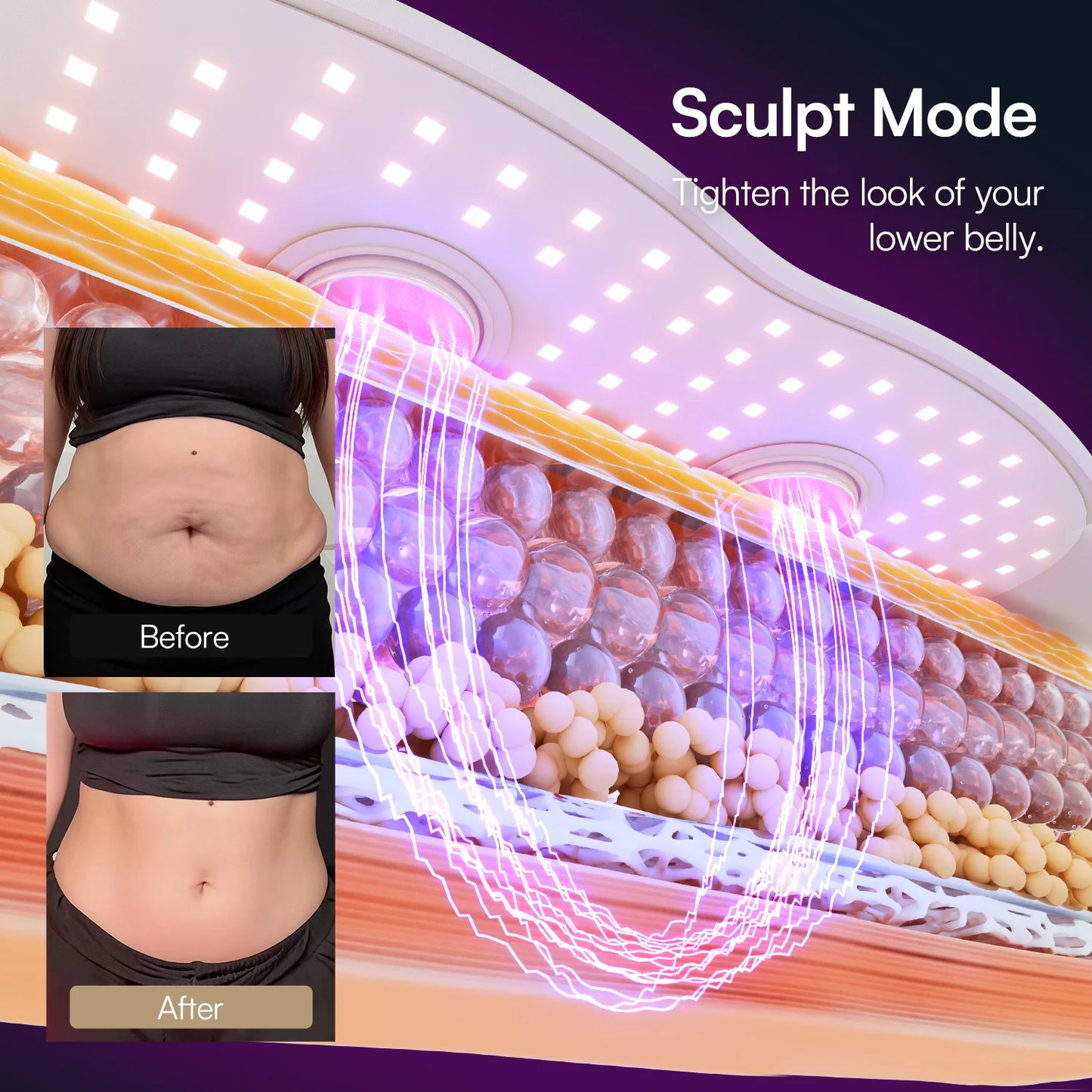CoreRestore™ Postpartum & Diastasis Support Belt For Mothers