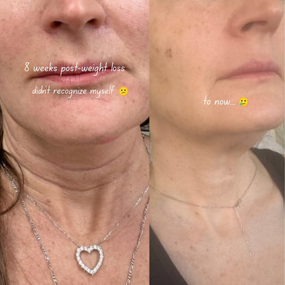 Face & Neck Firming Retinal Stick